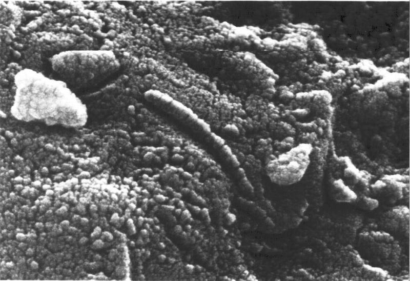 Structures within the ALH84001 meteorite, debated as Martian life.